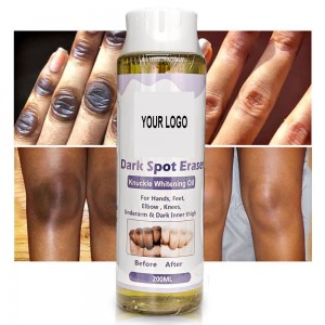 OEM Beauty Soap Oil Skin Whitening Lightening Knee Hand Elbow Dark Spot Removal Reduce Melanin Knuckle Whitening Set