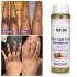 OEM Beauty Soap Oil Skin Whitening Lightening Knee Hand Elbow Dark Spot Removal Reduce Melanin Knuckle Whitening Set