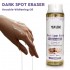 OEM Beauty Soap Oil Skin Whitening Lightening Knee Hand Elbow Dark Spot Removal Reduce Melanin Knuckle Whitening Set