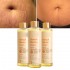 Wholesale OEM Natural Ingredient Skincare Oil Skin Healthcare Stretch Mark and Scar Removal 200ml Stretch Mark Oil