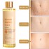 Wholesale OEM Natural Ingredient Skincare Oil Skin Healthcare Stretch Mark and Scar Removal 200ml Stretch Mark Oil